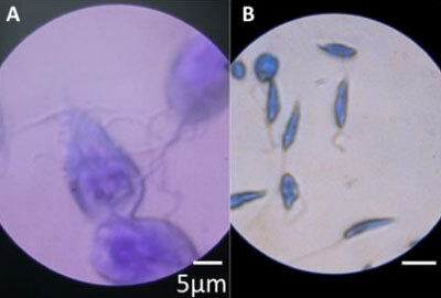 microbios-microscopio