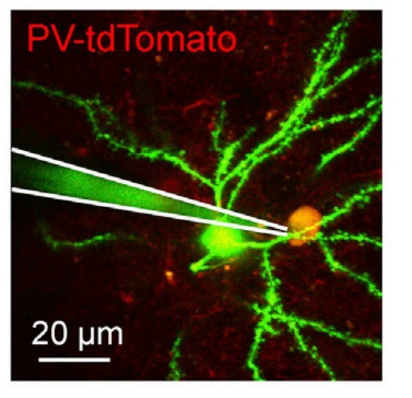 sinapsis-neurona-2