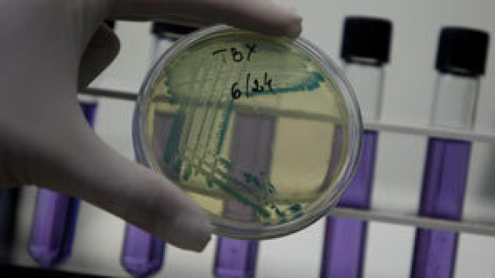 Image: La cepa letal de la E. coli