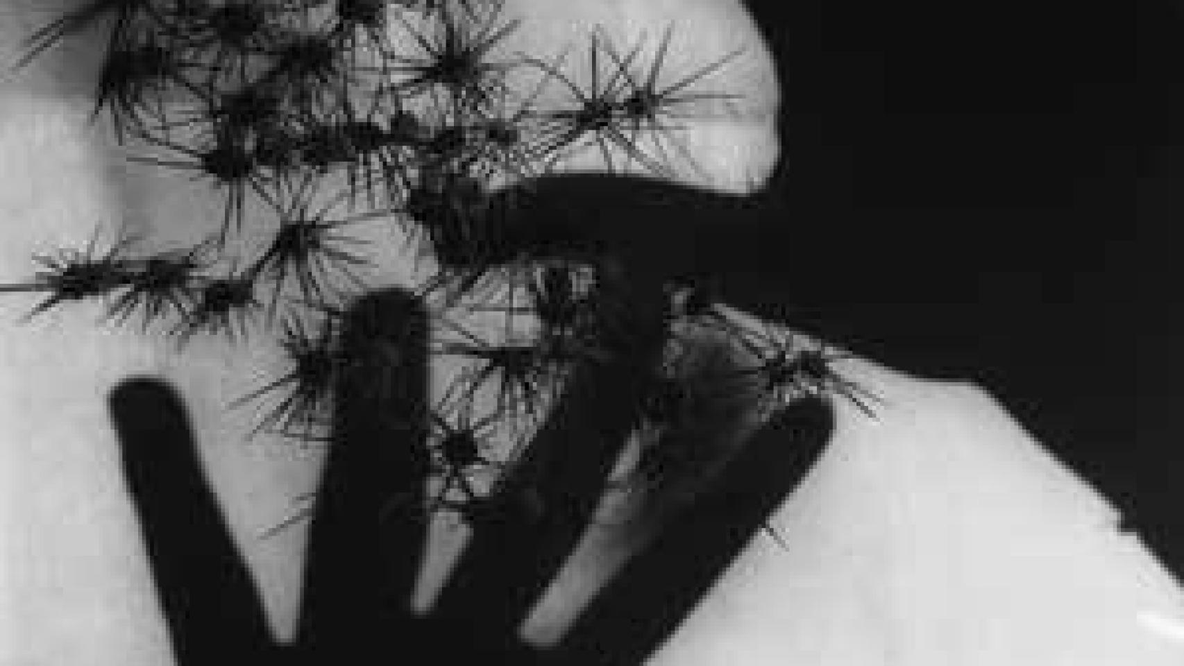 Image: La única diferencia