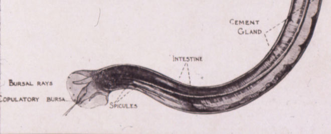 gusano-intestino