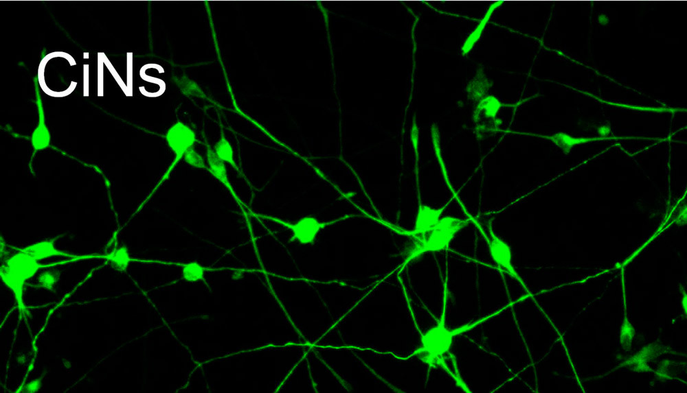 celulas-neuronas