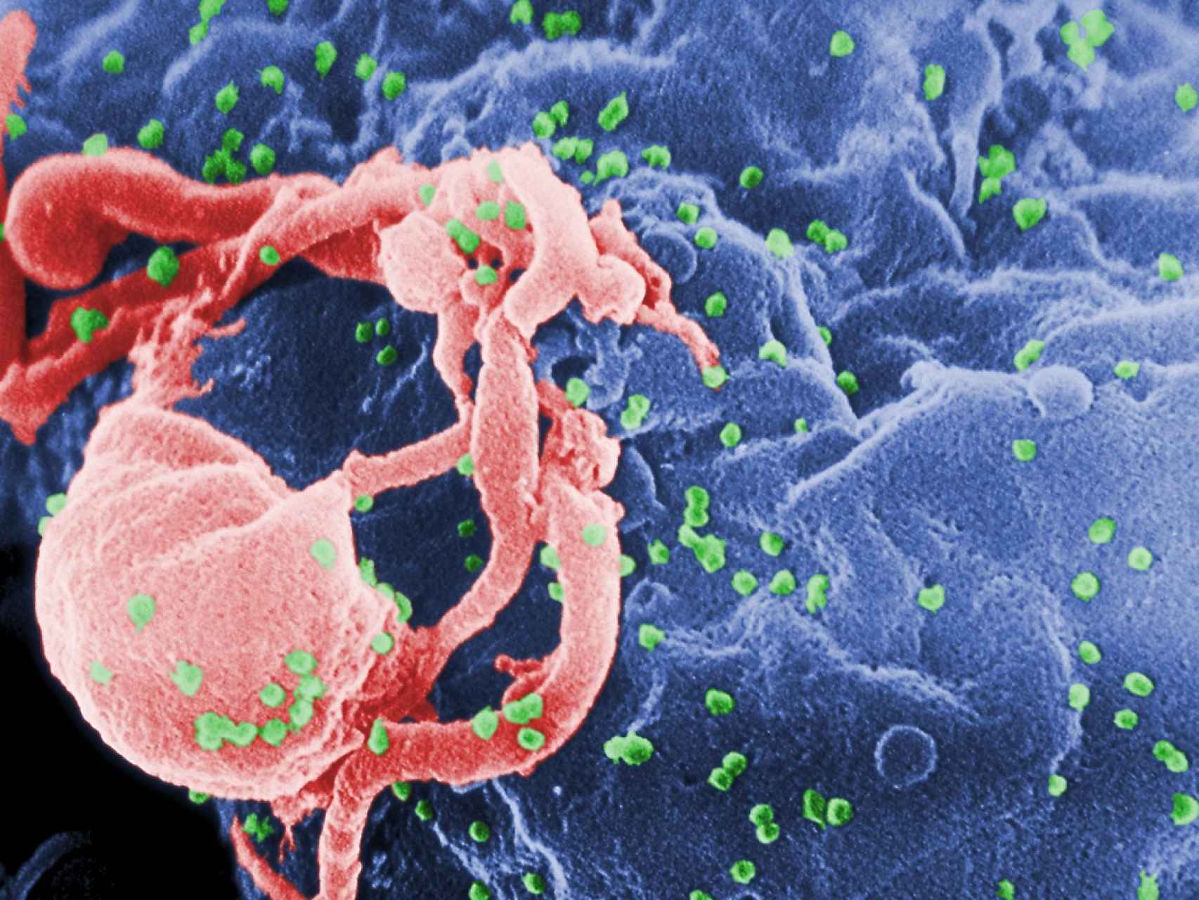 El VIH se acopla a la célula.