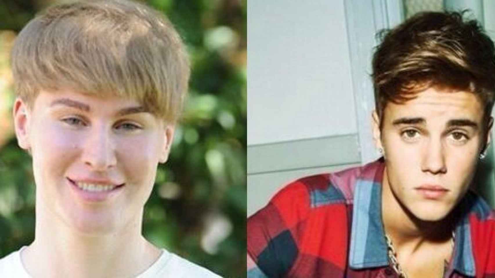 El fan de Justin Bieber que se operó para parecerse a su ídolo