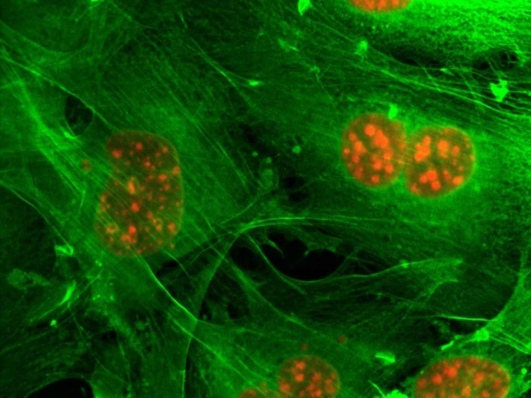 Células tumorales fluorescentes bajo el microscopio.