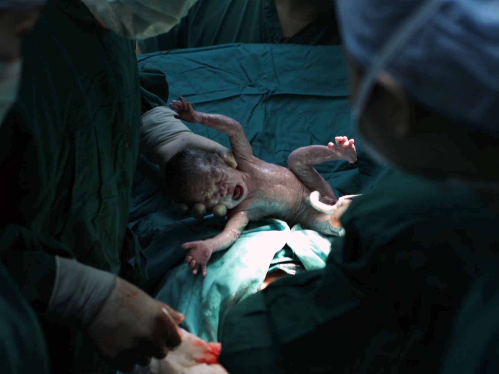 Un niño nacido por cesárea en un hospital chino.