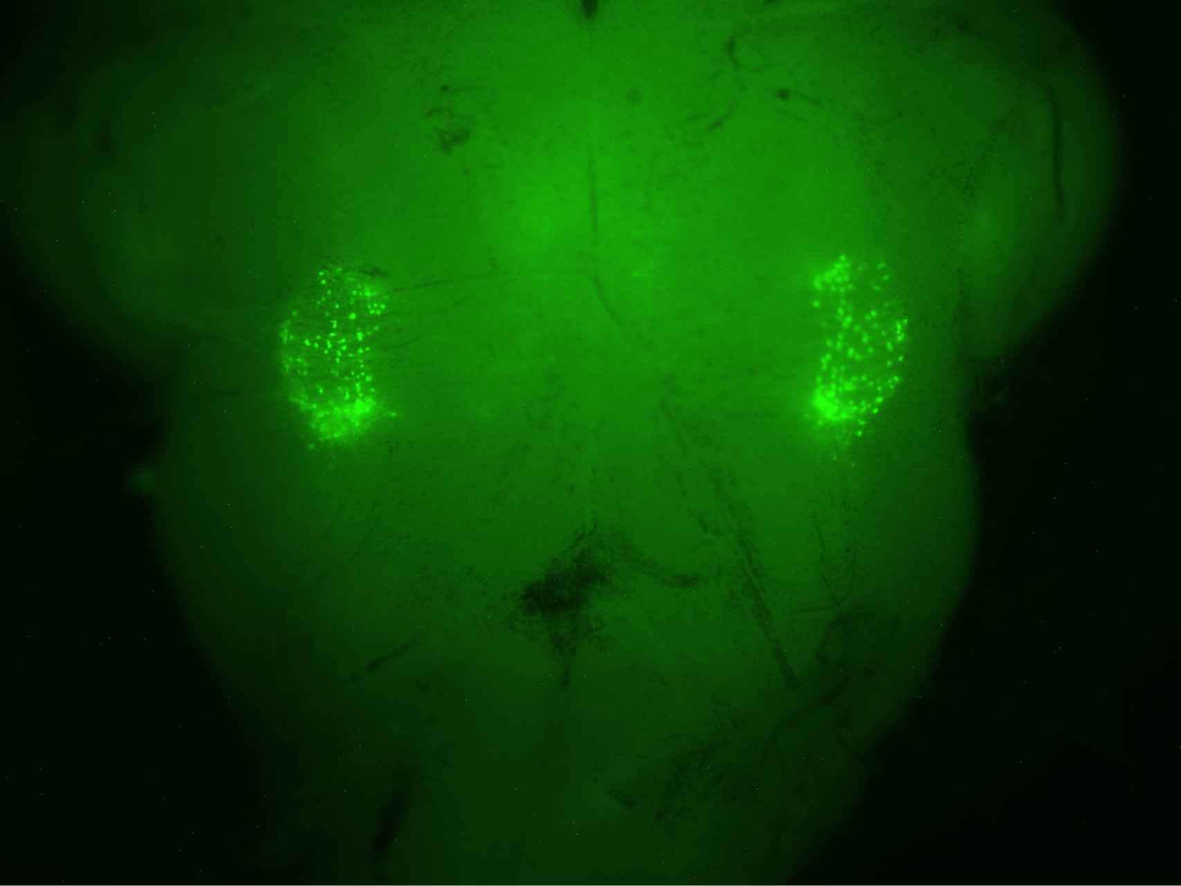 Tronco del encéfalo con las neuronas que controlan el suspiro encendidas.