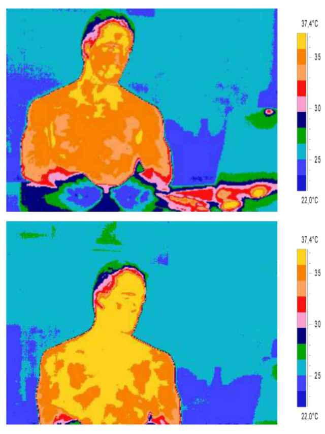 Imagen comparativa de la temperatura corporal entre el antes (arriba) y el después de ver a la amada.