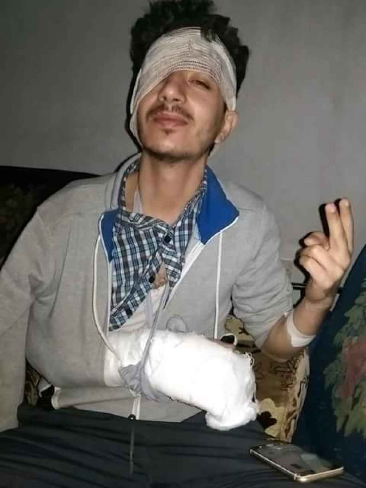 Mahmoud con su brazo escayolado.