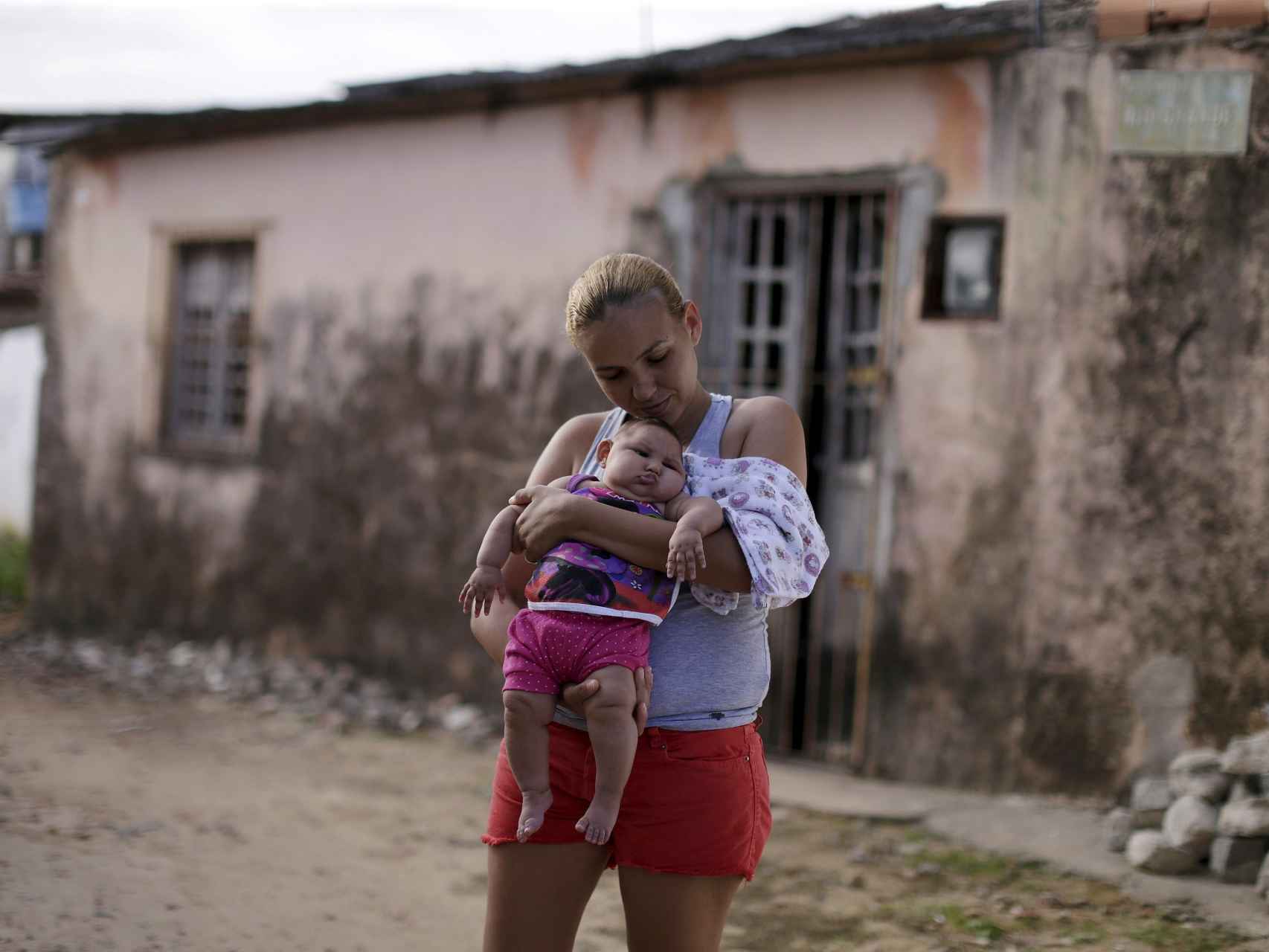 Una madre sostiene a su hija con microcefalia.