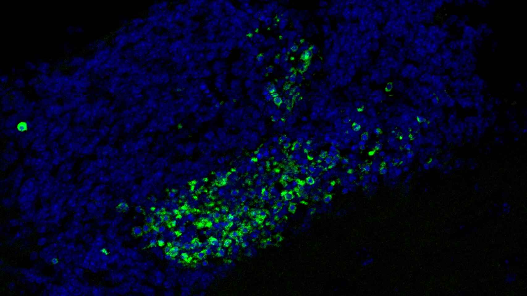 Acumulación de células muertas (verdes) en el cerebro en un ratón sin receptores Mer y Axl.