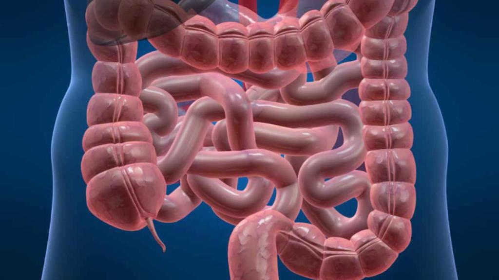 Imagen del intestino sano.