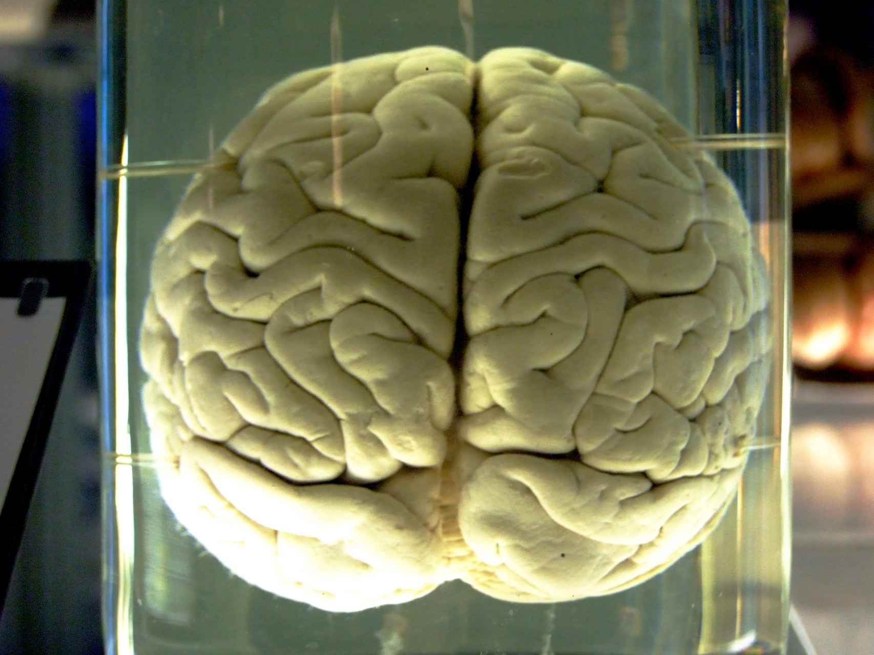 Cerebro de un chimpancé en el Museo de Ciencia de Londres.