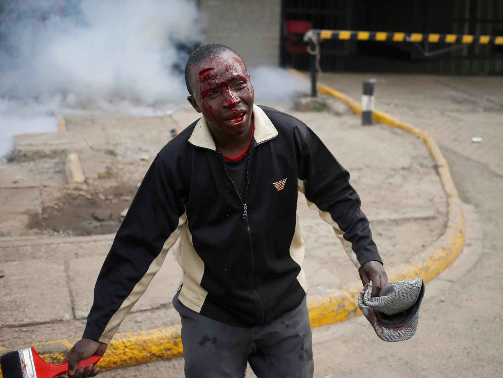 Uno de los heridos en la manifestación de Nairobi