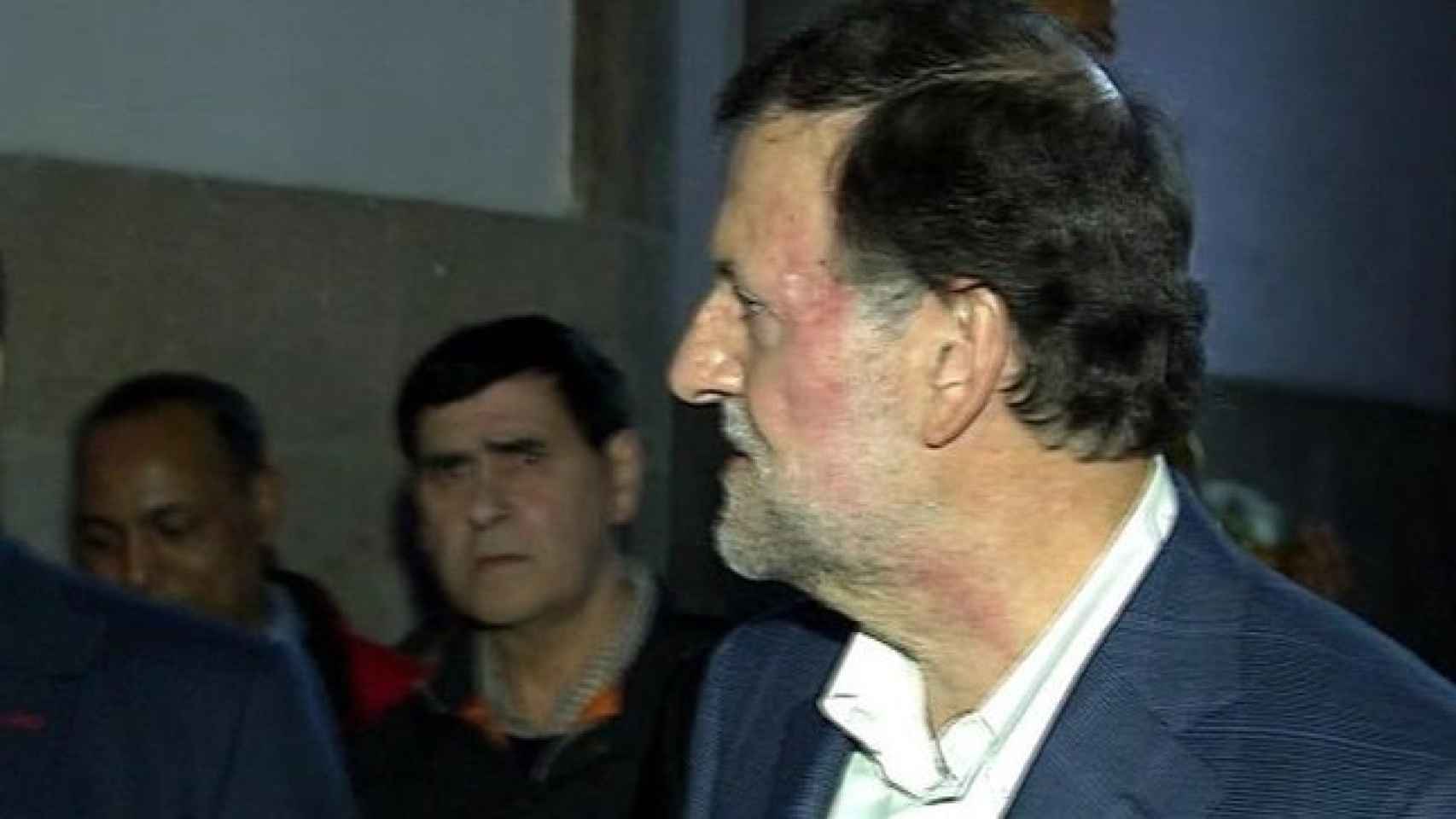 Imagen de Mariano Rajoy tras recibir un puñetazo en Pontevedra.