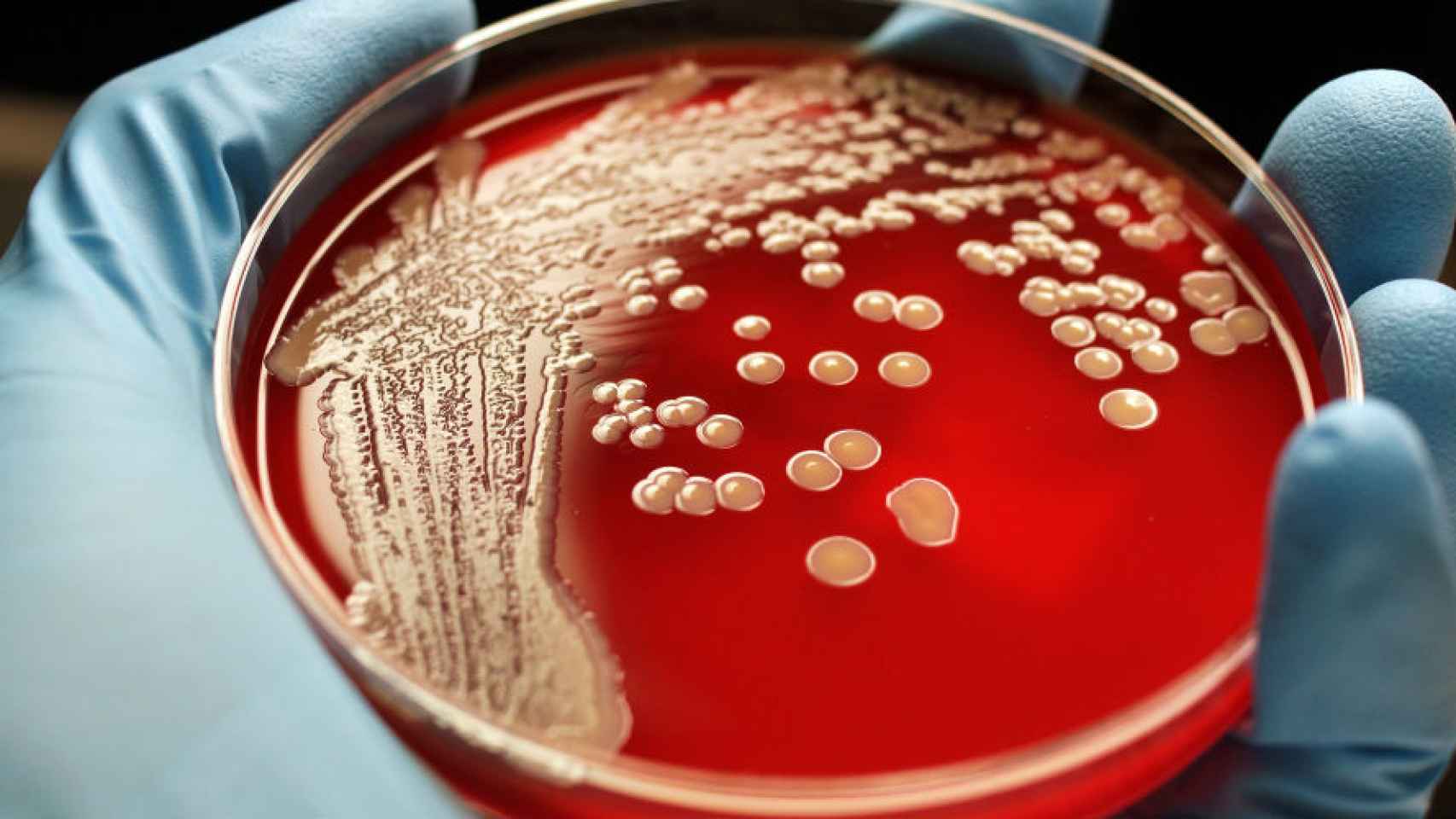 compuesto_antibacterias