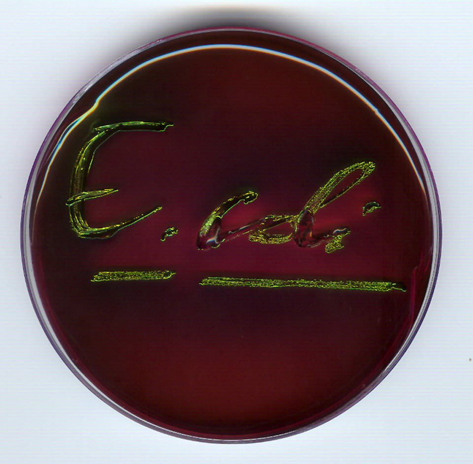 cultivo_e_coli
