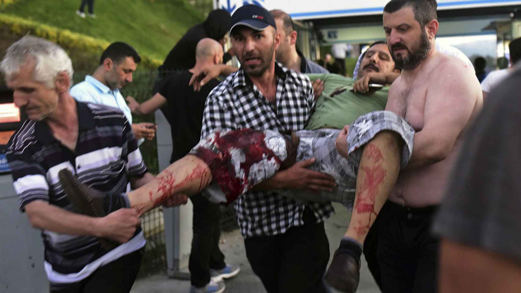 Un ciudadano herido en Estambul durante el golpe de Estado