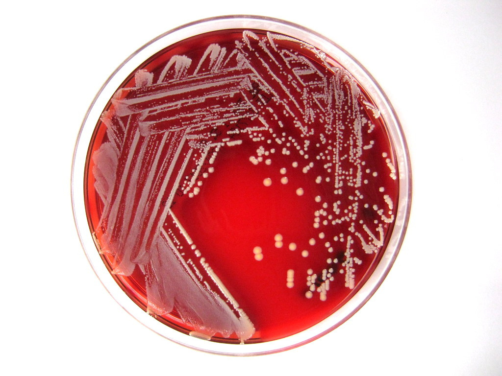 staphylococcus_lugdunensis