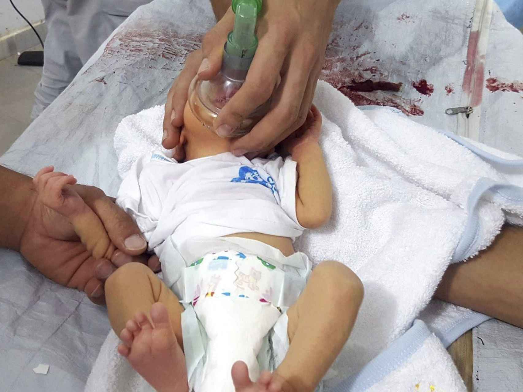Un bebé recibe atención médica en Saraqeb (Idlib, Siria) tras el supuesto ataque con gas cloro.