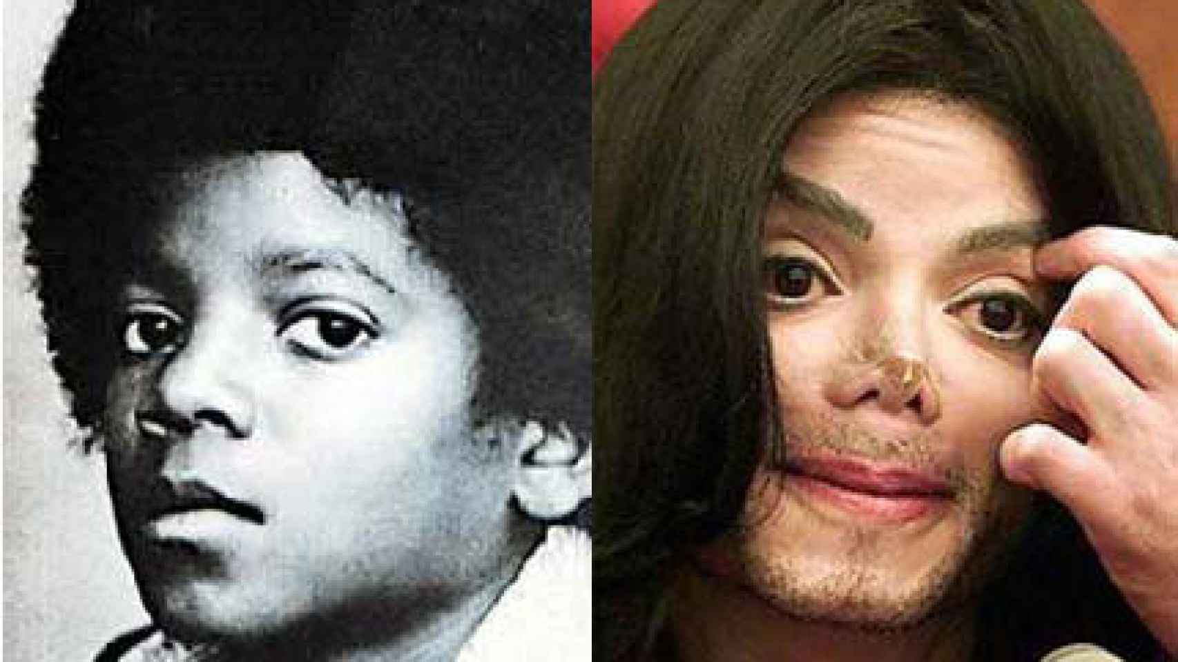 El antes y después de Michael Jackson.