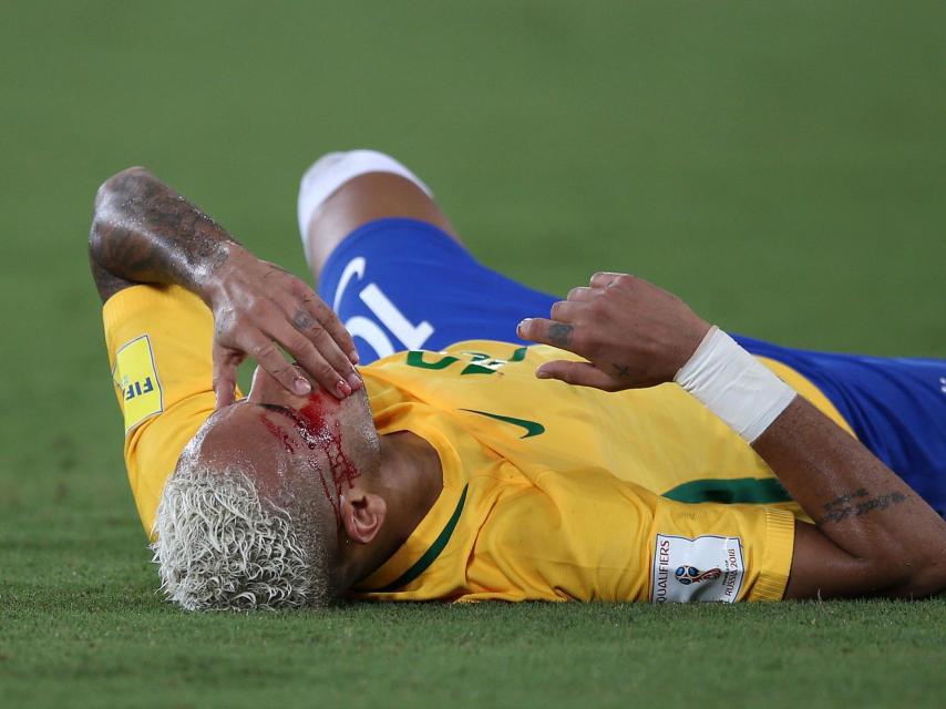 Neymar ensangrentado en el partido Brasil - Bolivia.