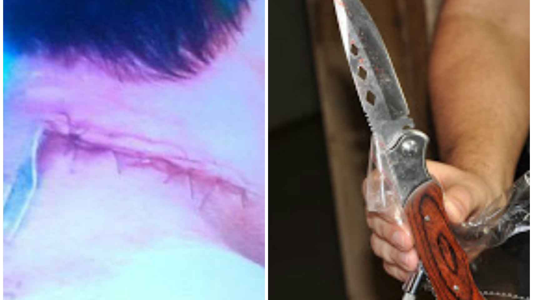 La herida que causó Patrick a su profesor y el cuchillo que utilizó.