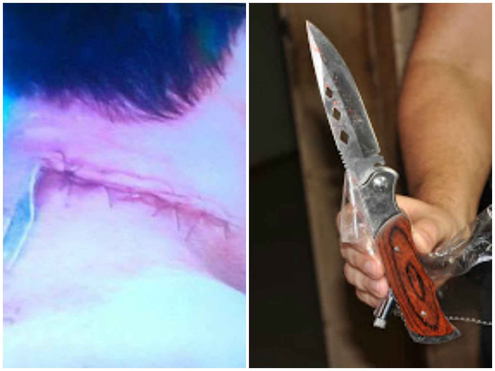 La herida que causó Patrick a su profesor y el cuchillo que utilizó.