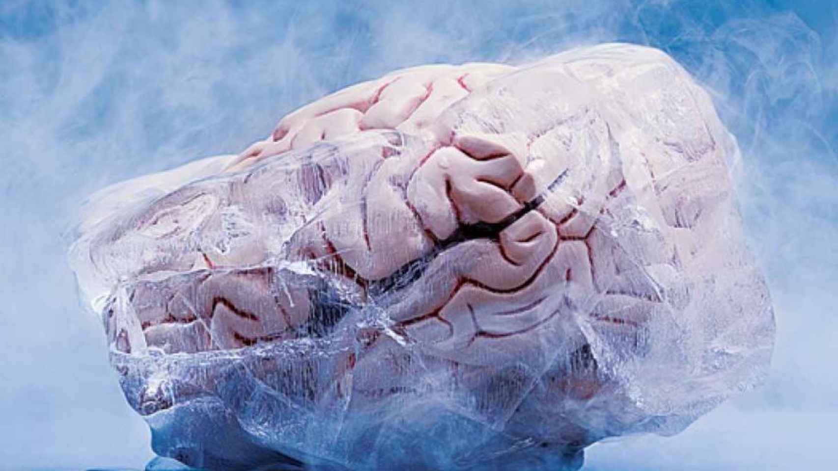 Una representación de un cerebro criopreservado