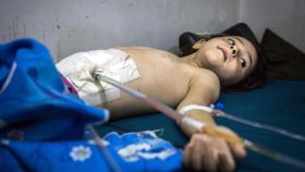 Un niño de 5 años, herido en el abdomen por la metralla de un bombardeo sobre el este de Alepo.