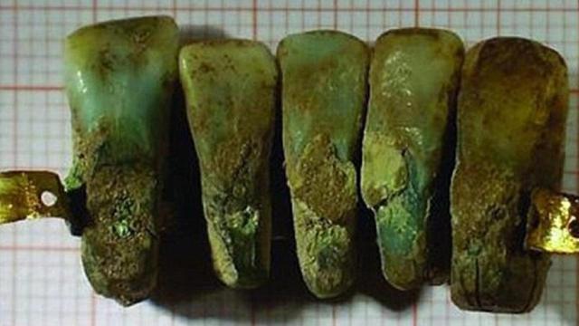 protesis_dental_mas_antigua