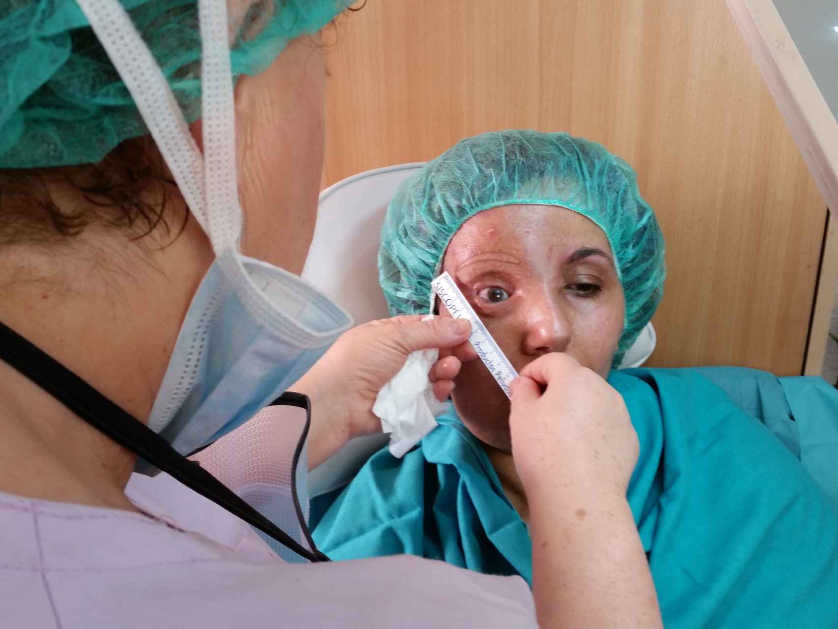 A Samira, tras extirparle el tumor, se le fijó un ojo de cristal y se le tatuó la ceja derecha.