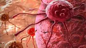 Ilustración de una célula cancerosa.