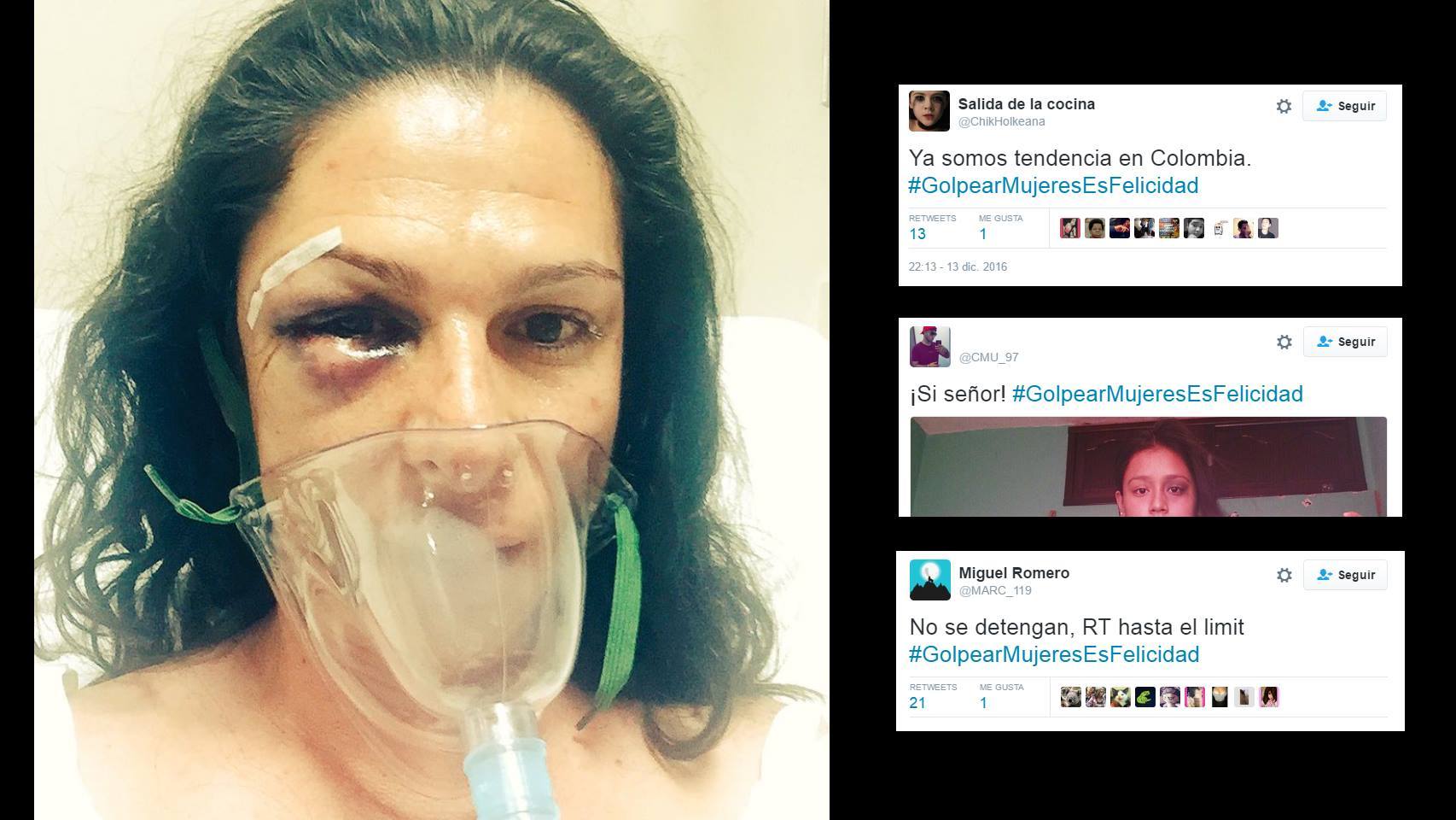 La imagen tras la agresión que subió Ana Guevara; a la derecha, los tuits que la ridiculizan.