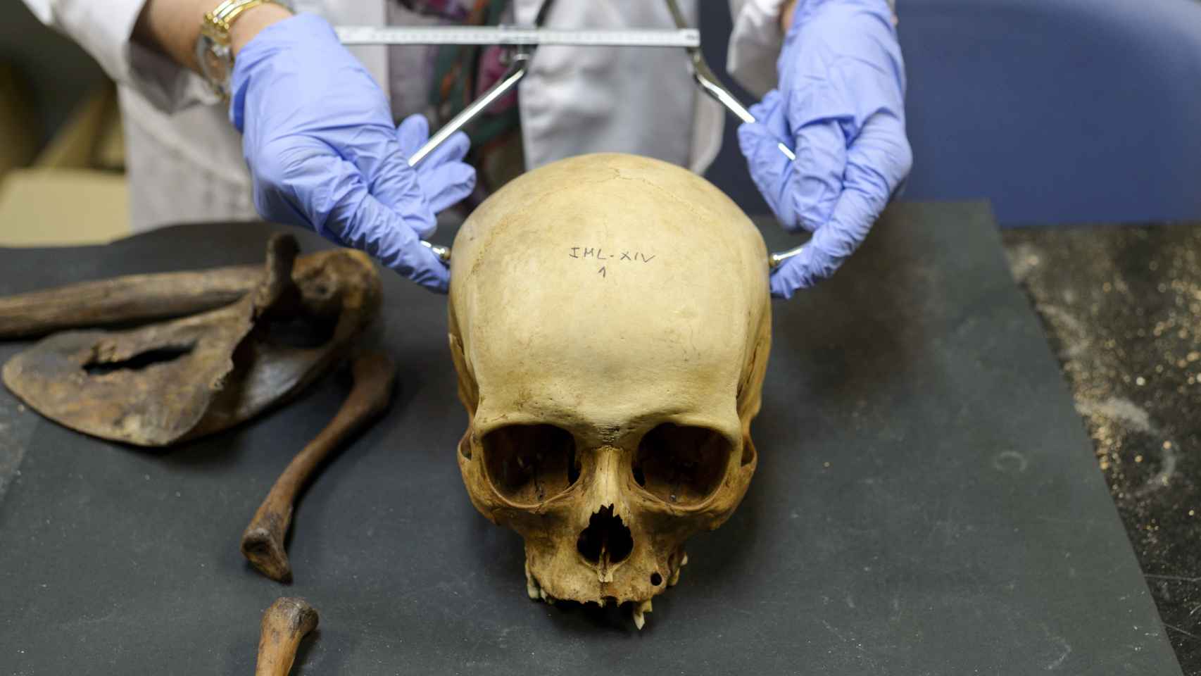 Los forenses estudian el cráneo del cadáver para averiguar datos sobre la persona fallecida como la raza.
