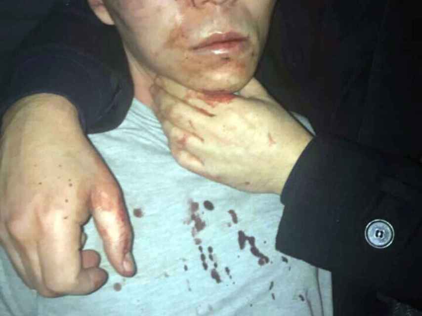 Fotografía del sospechoso del ataque, Abdulkadir Masharipov, tras ser arrestado.