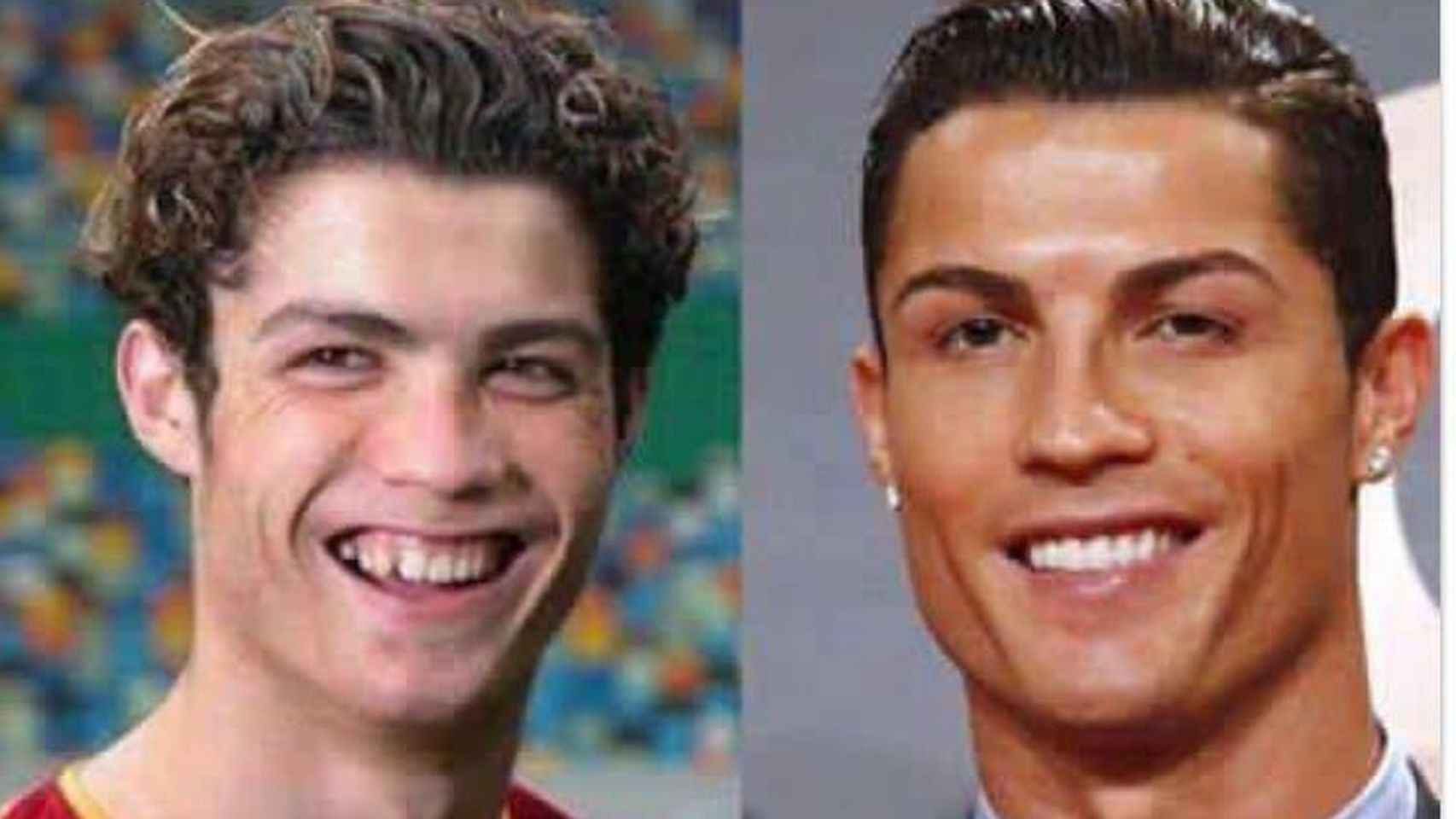 Cristiano, antes y después.
