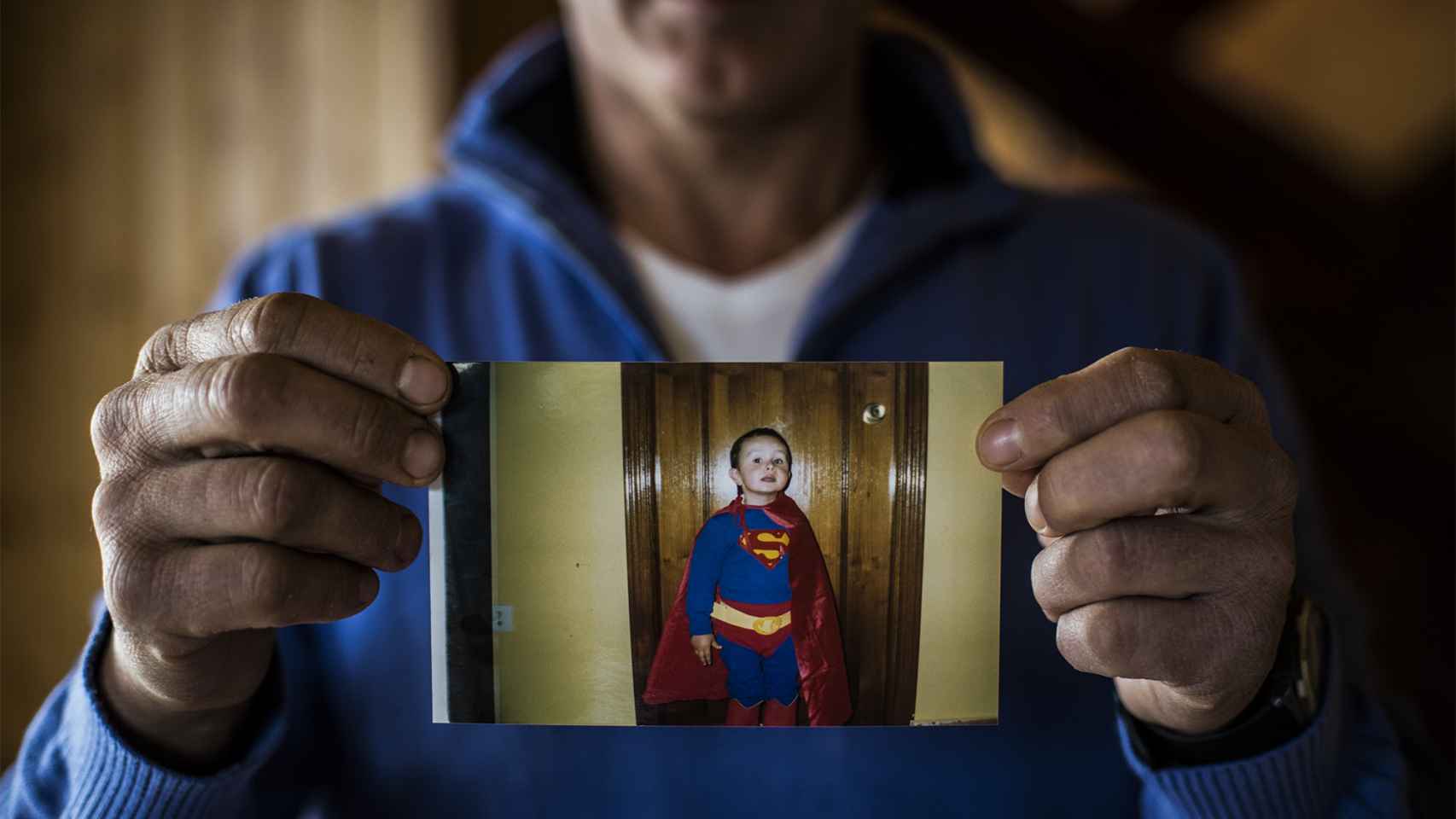 Su padre Ángel muestra una fotografía de cuando su hijo aún no había sufrido de sinusitis