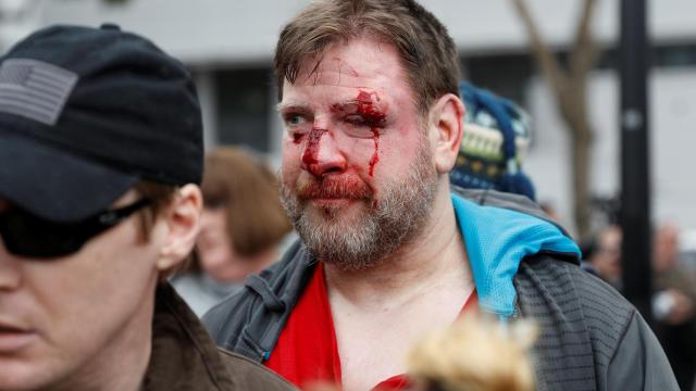 Uno de los partidarios de Trump heridos en Berkeley.