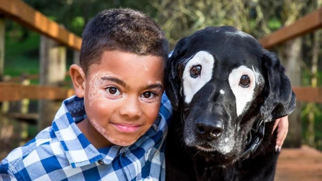 Carter, uno de los niños en los que  Rowdy  ha causado un impacto positivo