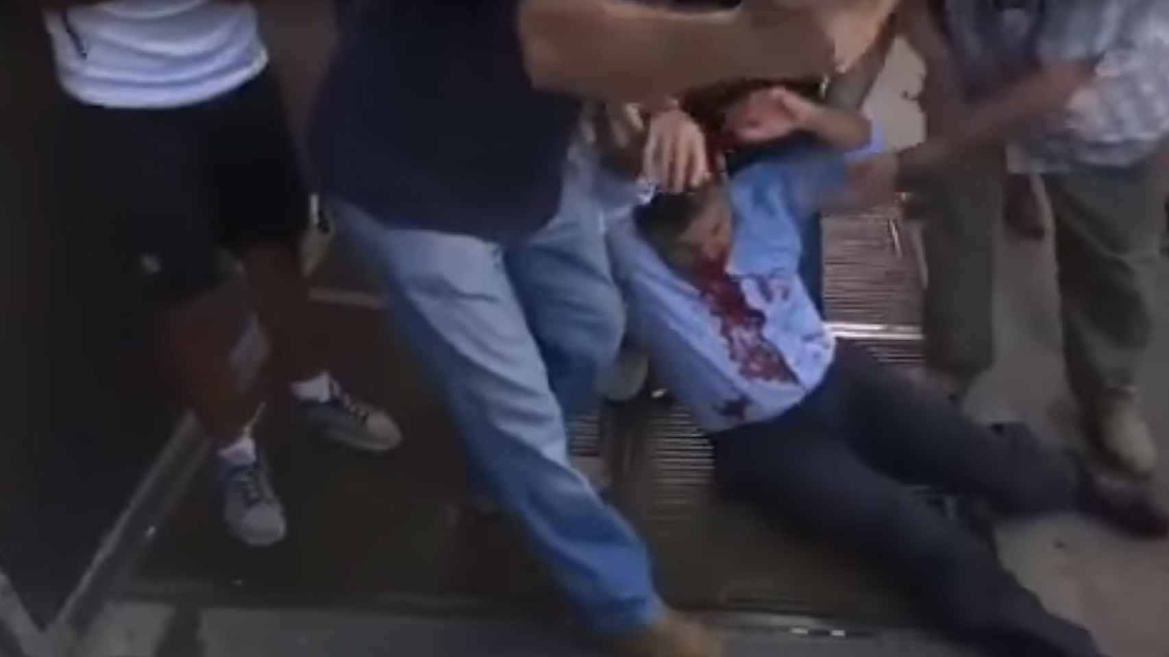 La policía paraguaya dispara en la cara de un diputado opositor.