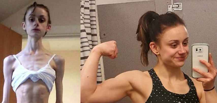 El montaje del antes y después que Fiona Chrystall compartió en sus redes sociales