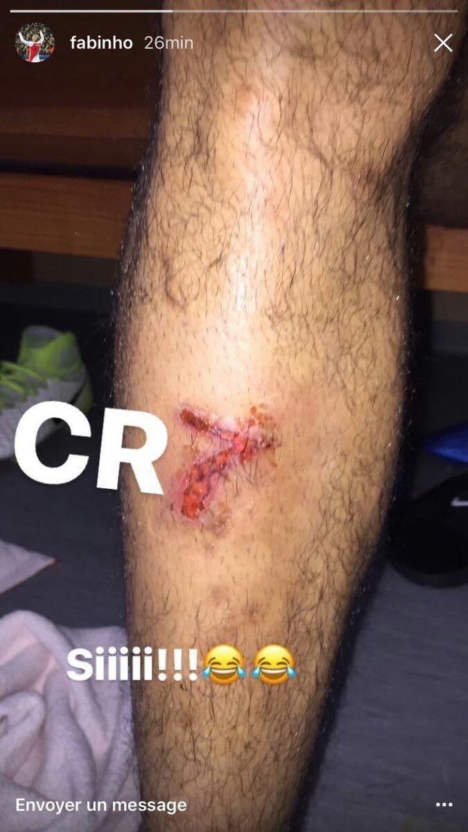 La herida de Fabinho con la que se acuerda de Cristiano Ronaldo