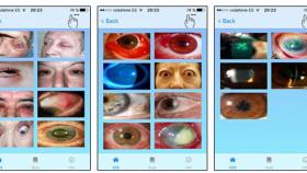 app-movil-oftalmologia-valladolid-ioba