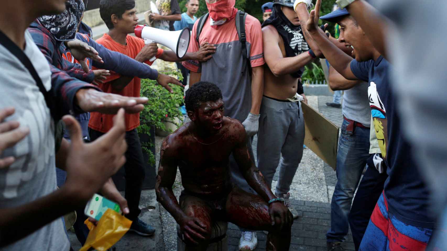 El herido, con graves quemaduras, rodeado de manifestantes
