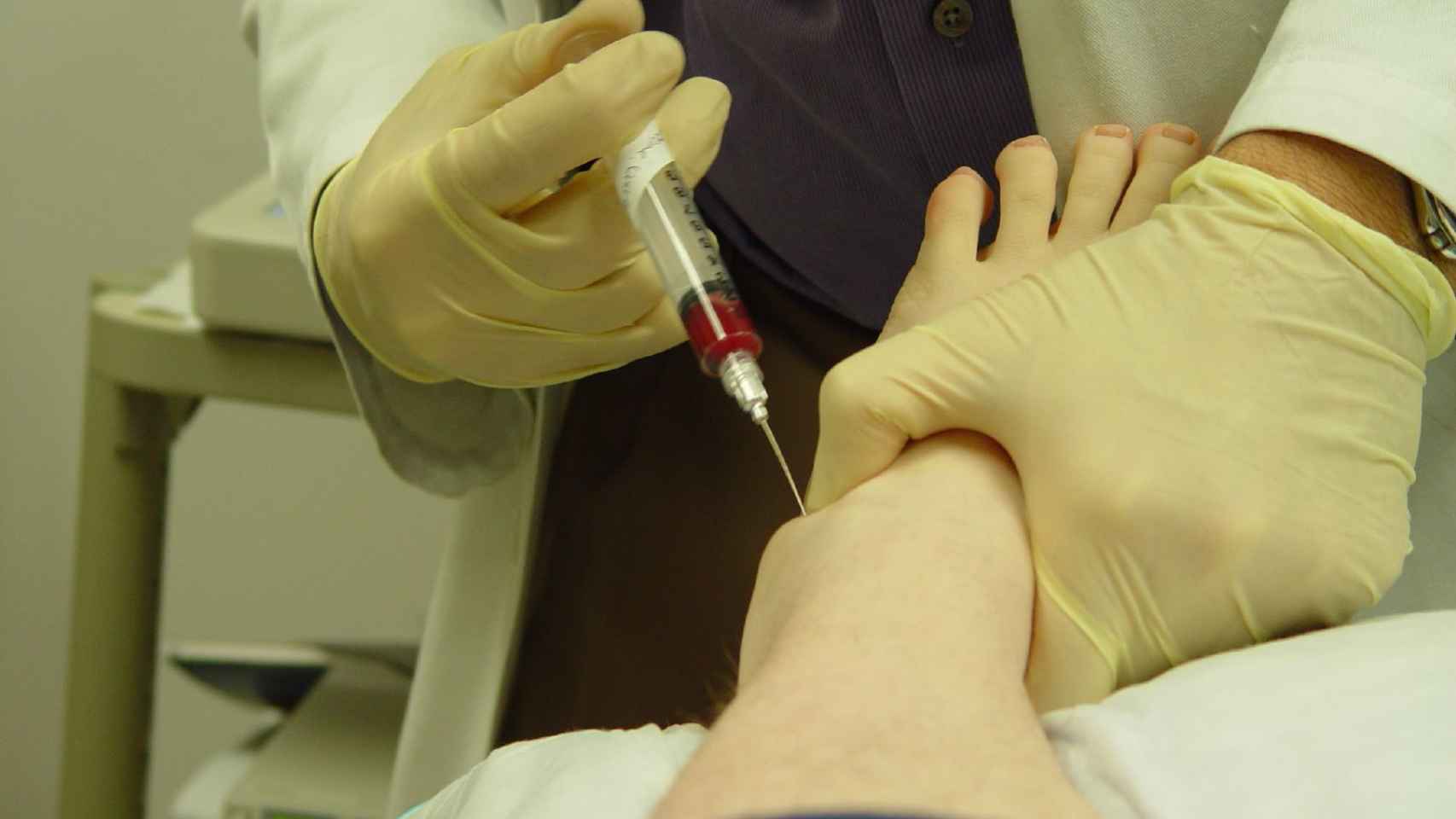 Inyección de plasma sanguíneo para tratar lesiones.