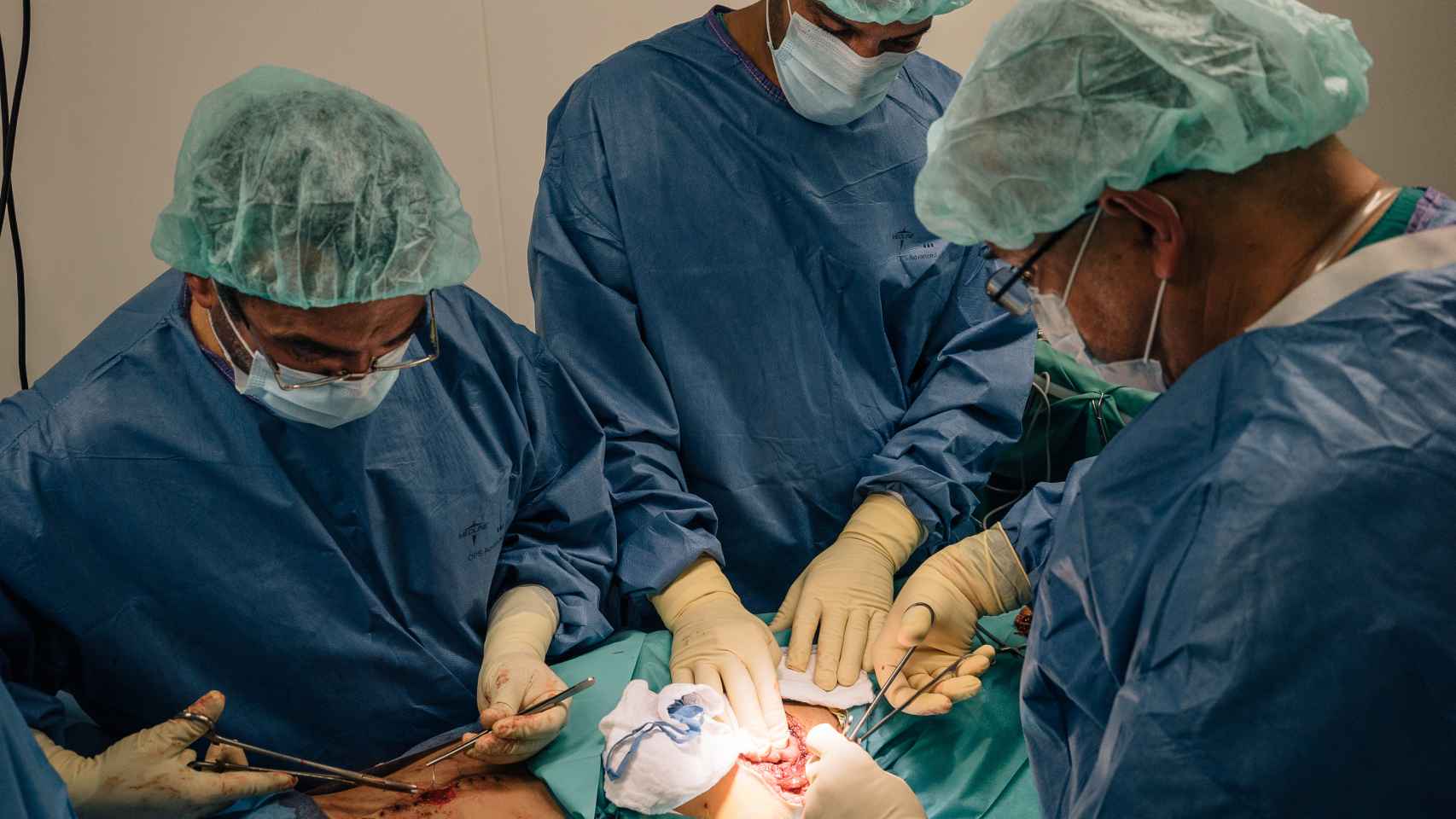 El cirujano de MSF Ridwan,  el cirujano auxiliar Mohammed y cirujano expatriado de MSF el Dr. Alexander realiza cirugía en una niña llamada Ilham, que fue herida en el abdomen y tiene una fractura en su pierna.