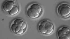 Image: Reparan una mutación genética en embriones humanos