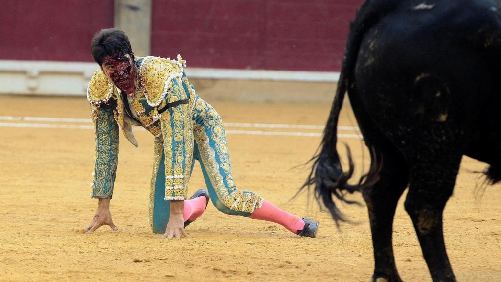 Cayetano Rivera tras la cogida.