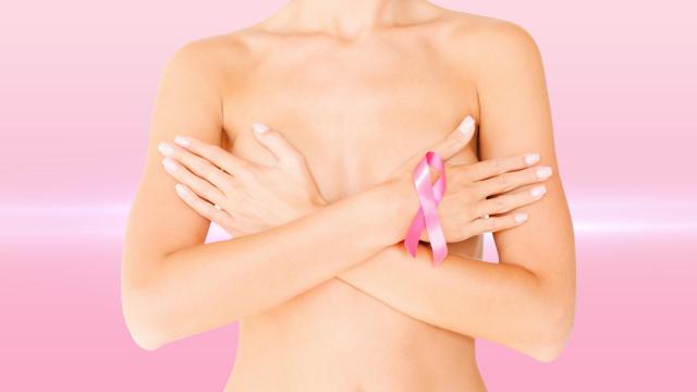 El cáncer de mama es el más frecuente en mujeres.